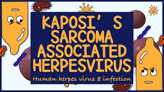 Kaposi Sarcoma Associated Herpes virus HHV 8 Morphology Diagnosis Treatment amp Prevention [upl. by Hajile]