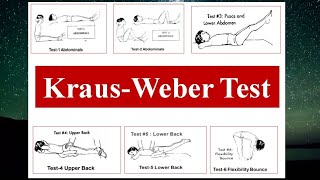 KRAUS WEBER TEST [upl. by Aire]