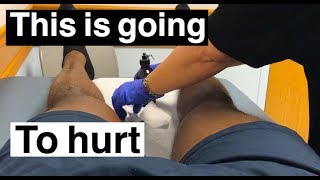 My First Cortisone Shot  Knee update [upl. by Ahsi]