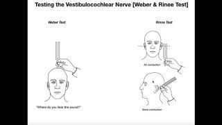 Interpreting the WeberRinne Tests EXPLAINED [upl. by Reffotsirk]