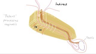 Anatomy of the inguinal region simplified [upl. by Natica]