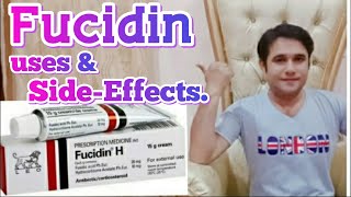 fucidin cream uses and side effects [upl. by Cinimod181]