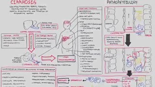 Liver Cirrhosis SandS Pathophysiology Investigations Management [upl. by Ihab]