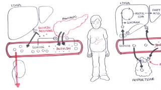 Diabetes Type II Pathophysiology [upl. by Press402]