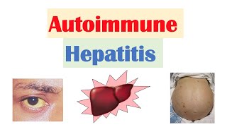 Autoimmune Hepatitis  Pathogenesis Signs amp Symptoms Diagnosis Treatment [upl. by Gayler298]