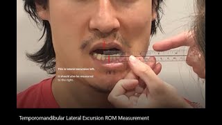 Range of Motion Temporomandibular TMJ Lateral Excursion [upl. by Rohn]