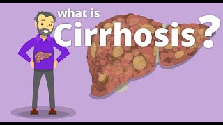 Cirrhosis  What is cirrhosis [upl. by Malachi]