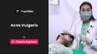 Acne Vulgaris  Dr Chesta Agrawal  Dermatology PrepClinic [upl. by Decca]