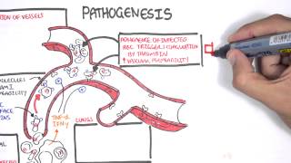 Malaria Pathophysiology [upl. by Tremann465]