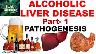 ALCOHOLIC LIVER DISEASE Part 1 Pathogenesis [upl. by Euqimod559]